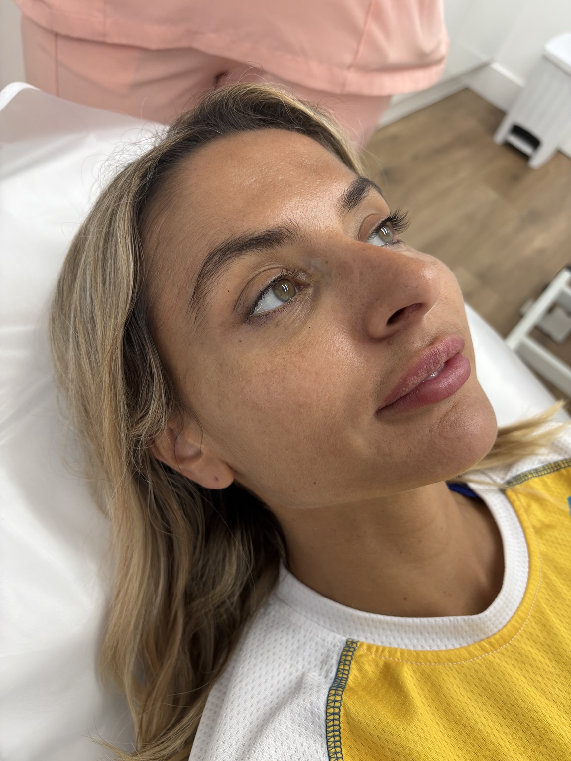 Before chemical peel treatment